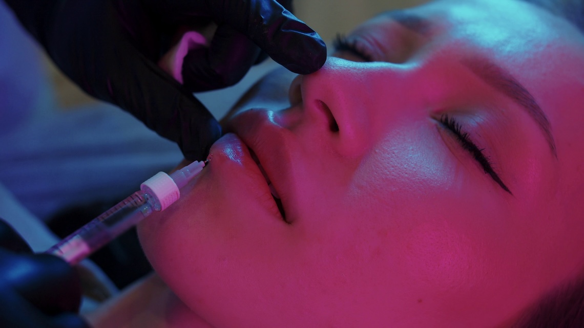 lip filling procedure inserting needle in the lower lip of female client under neon light